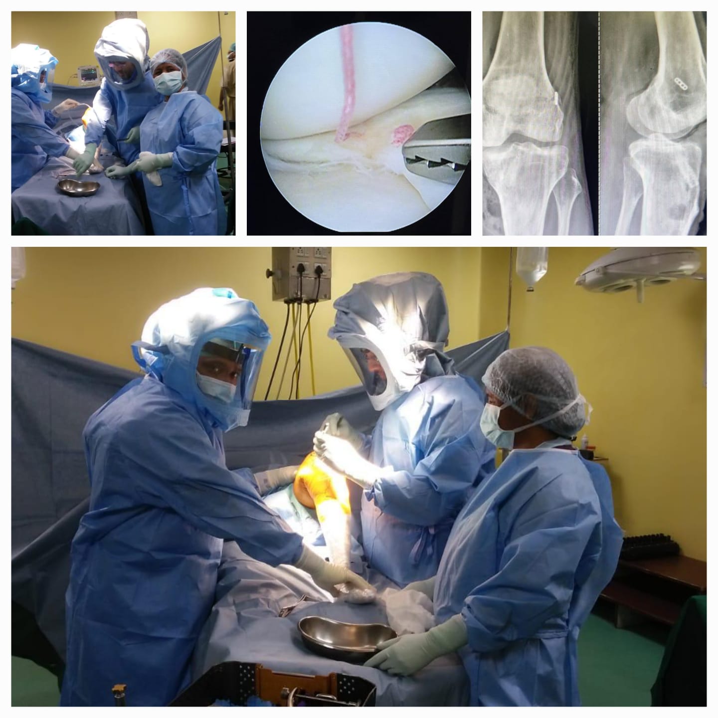 ARTHROSCOPY